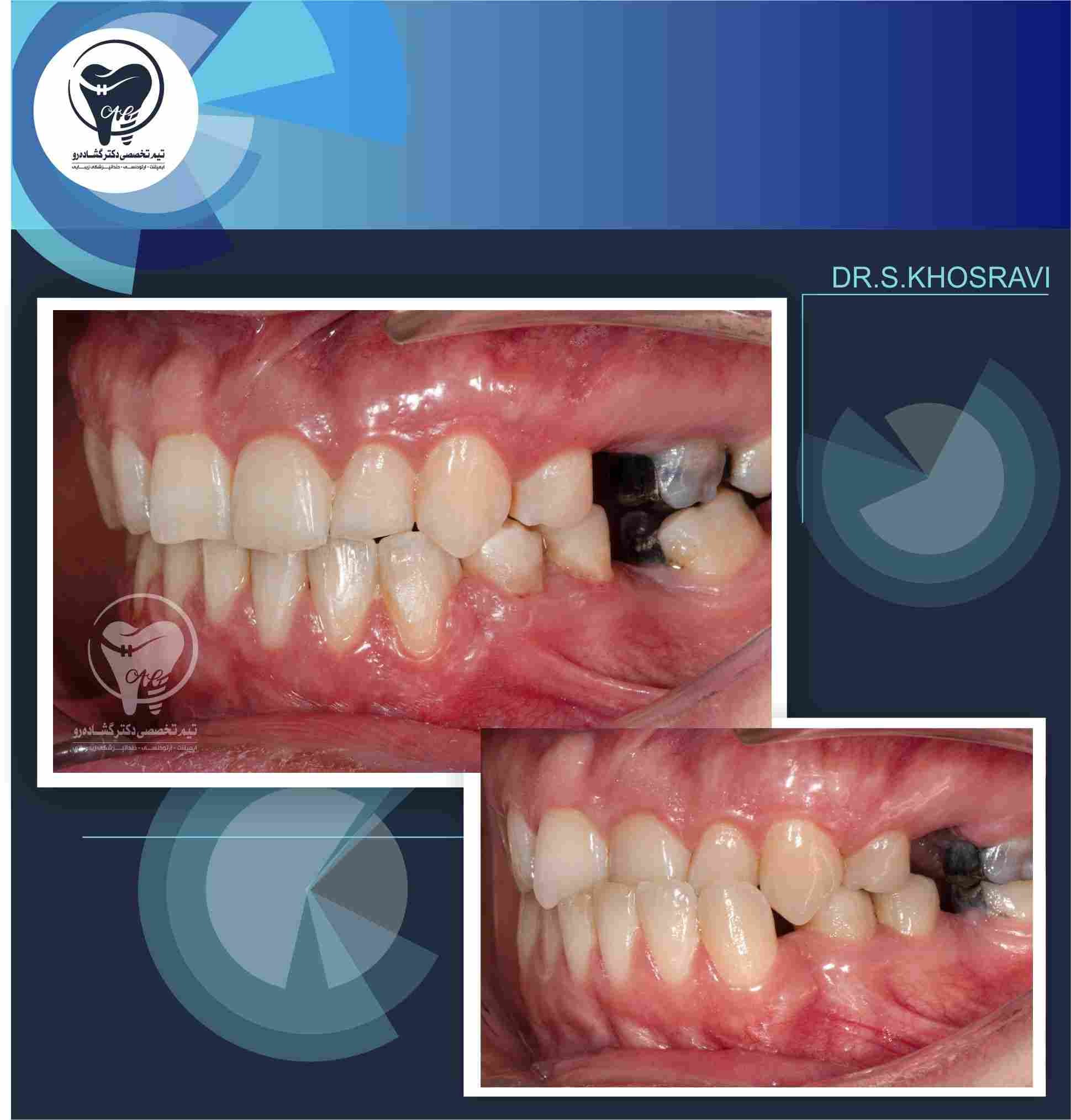 نمونه کار ارتودنسی
