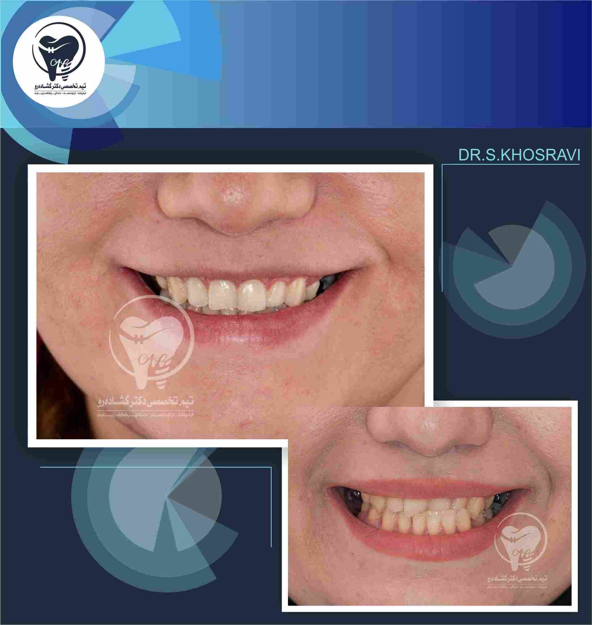 نمونه کار ارتودنسی