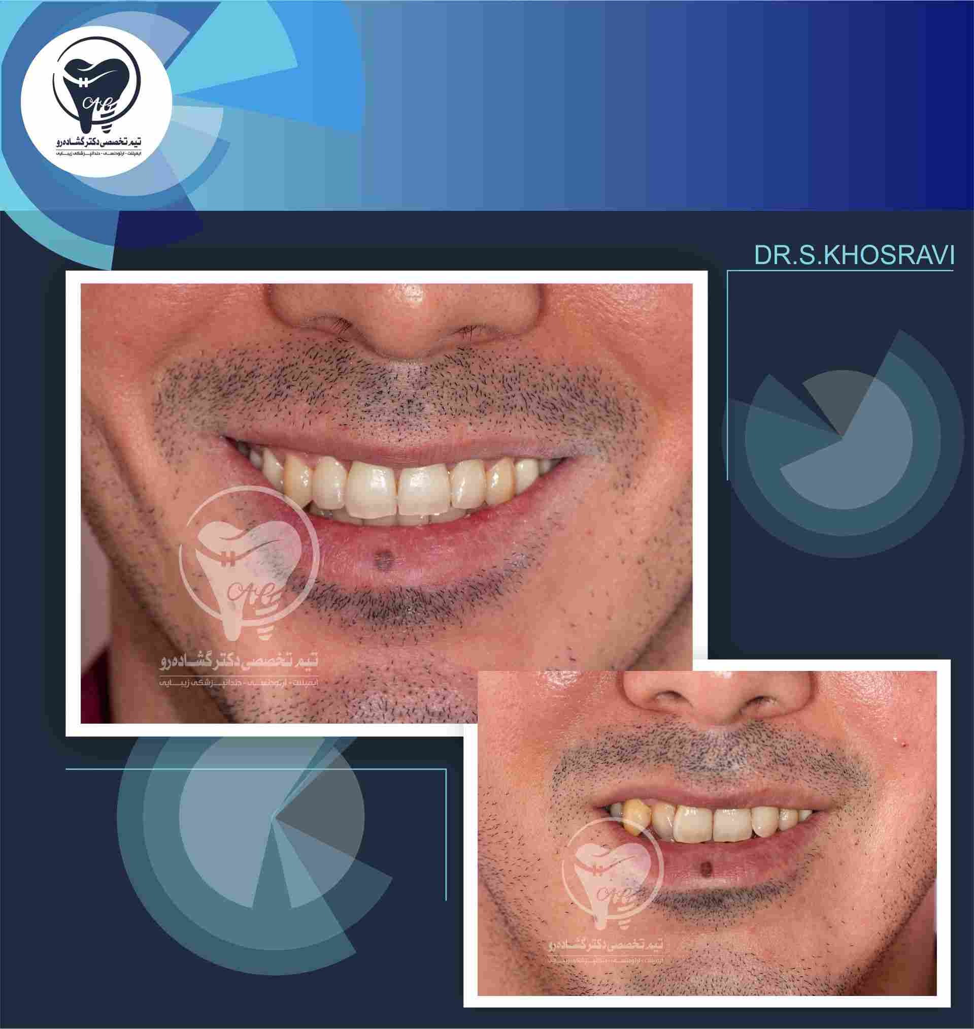نمونه کار ارتودنسی