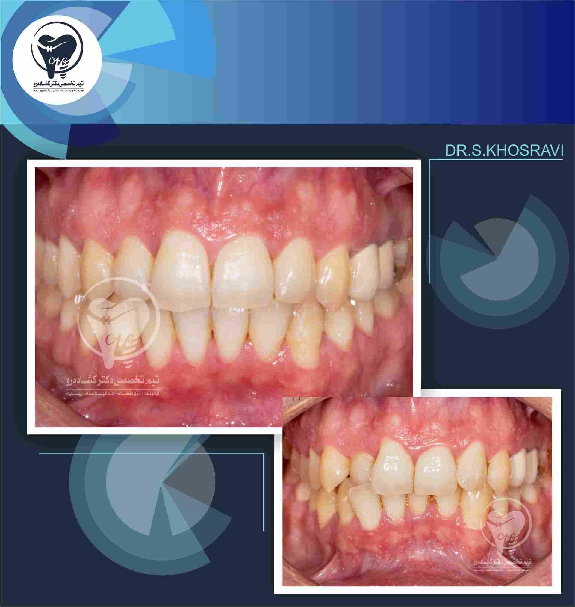 نمونه کار ارتودنسی
