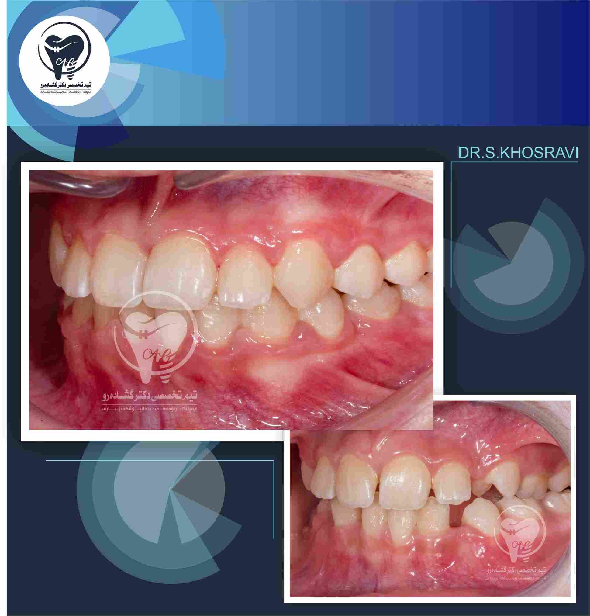 نمونه کار ارتودنسی