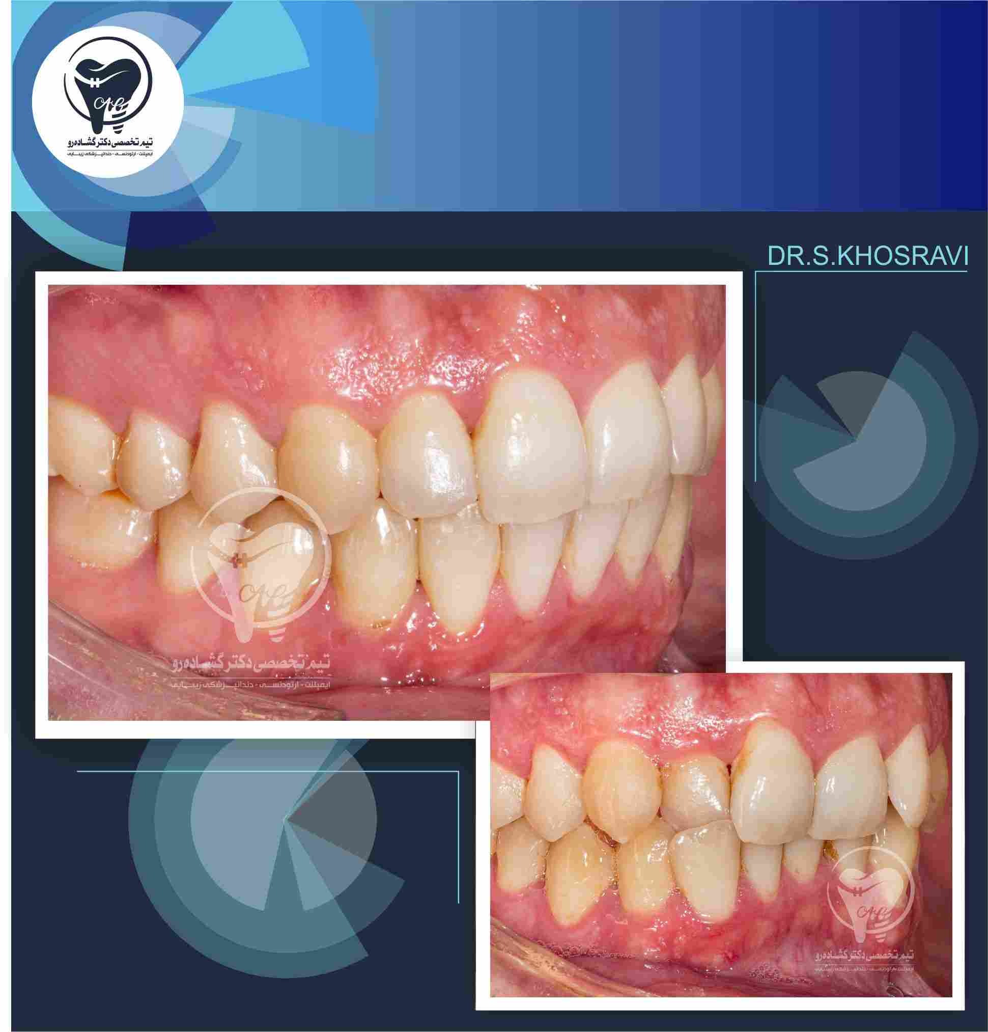 نمونه کار ارتودنسی