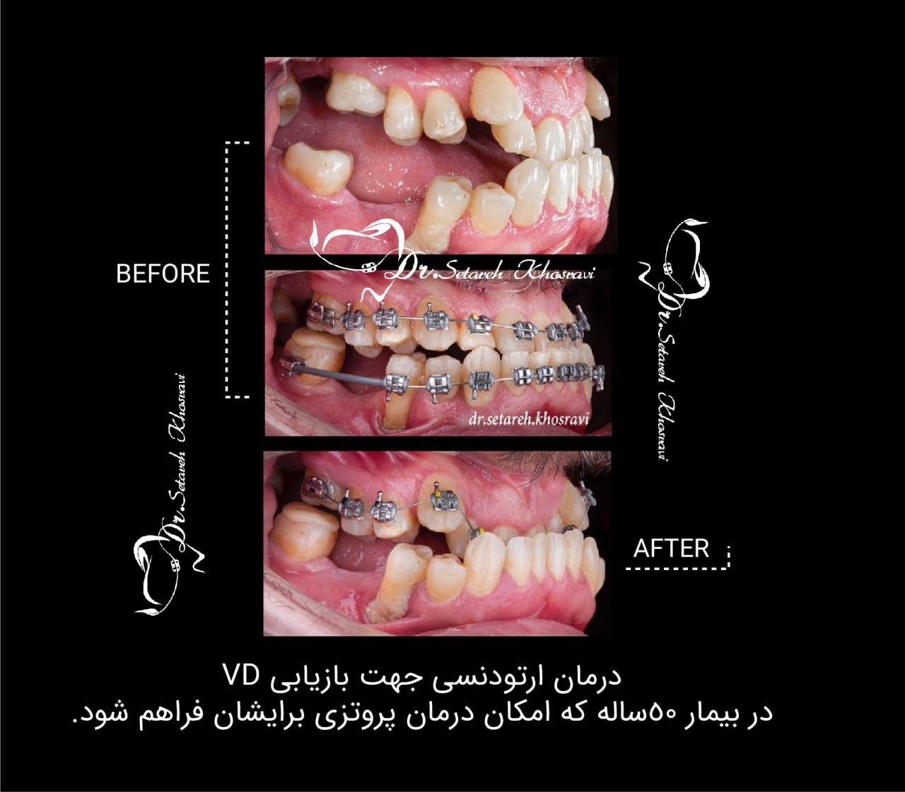 نمونه درمان6