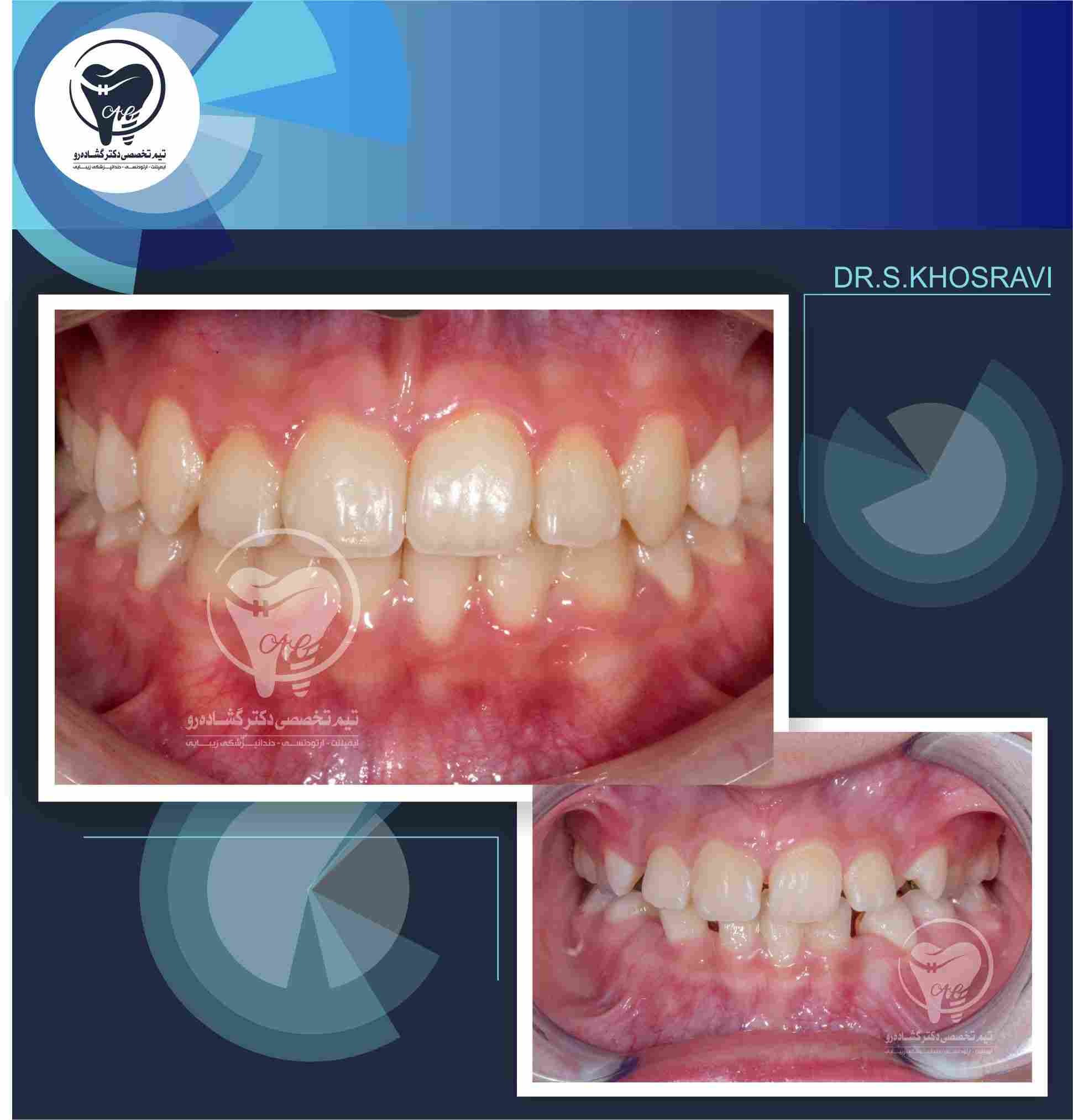 نمونه کار ارتودنسی