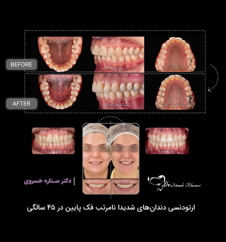 ارتودنسی