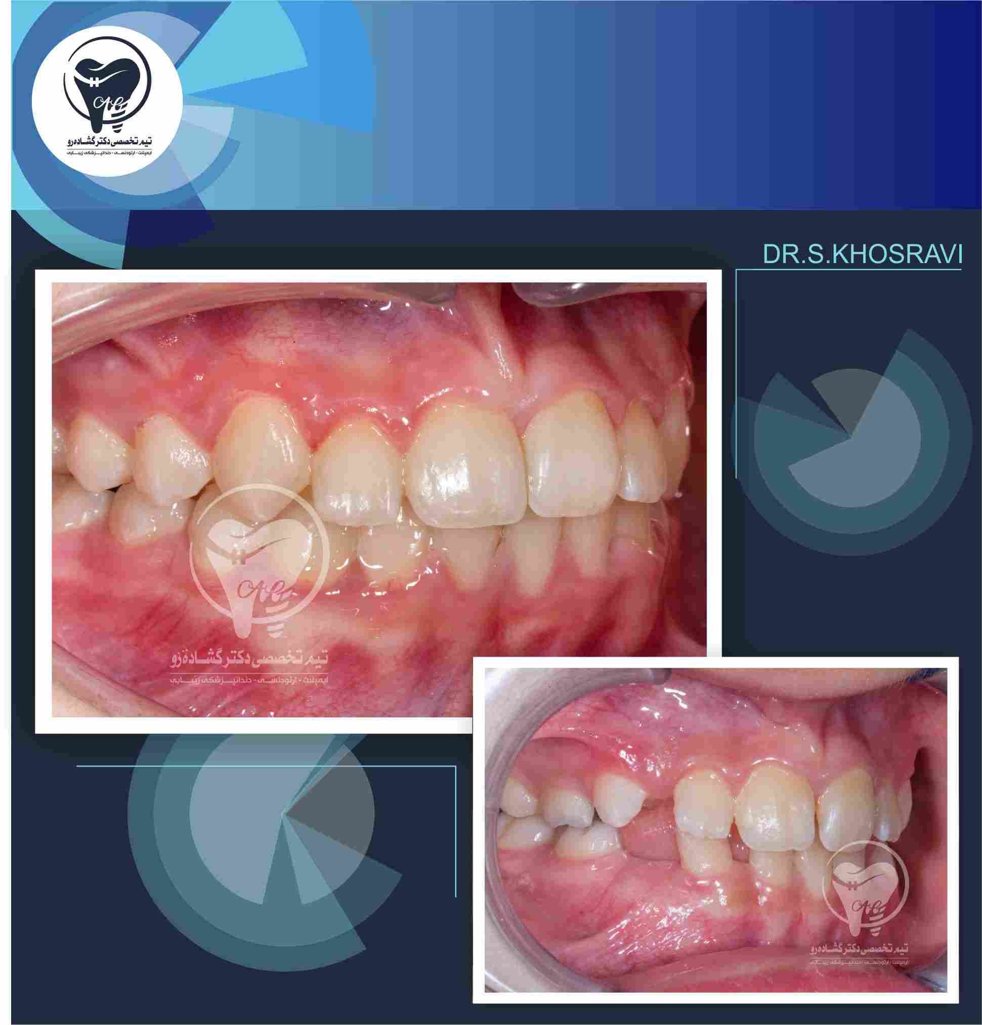 نمونه کار ارتودنسی