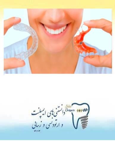 تثبیت کننده ارتودنسی یا ریتینر