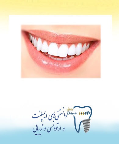 لبخند طلایی