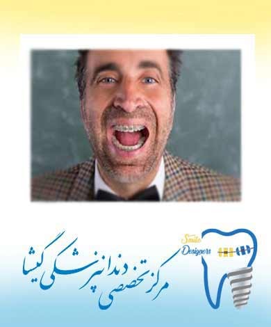 درمان ارتودنسی در بيماران بزرگسال توسط متخصص ارتودنسی در تهران