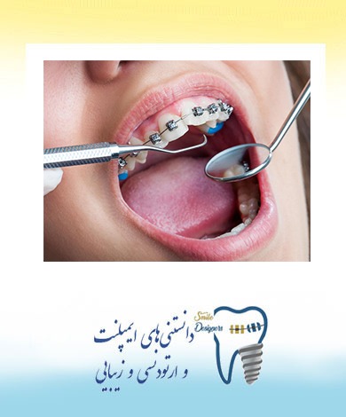 بهترین مطب ارتودنسی در تهران