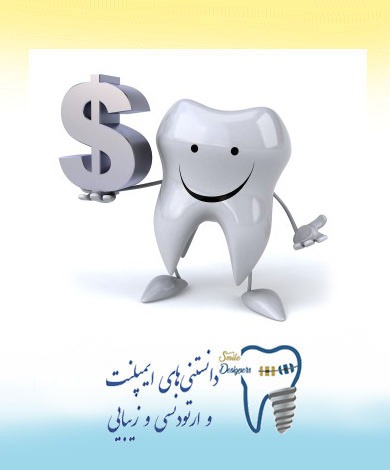 هزینه کاشت ایمپلنت دندان