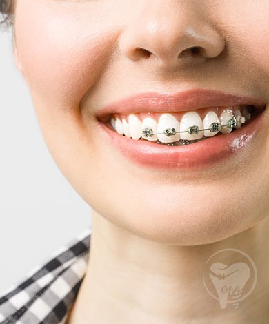 درد ارتودنسی را چگونه مدیریت کنیم ؟