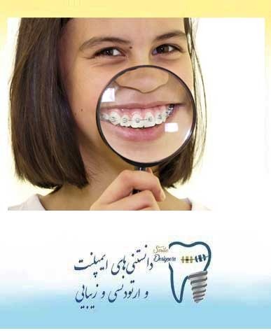 طولانی شدن دوره درمان  ارتودنسی چه عوارضی دارد؟
