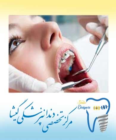 خصوصيات بهترین بيمار ارتودنسی از نظر متخصص ارتودنسی در تهران