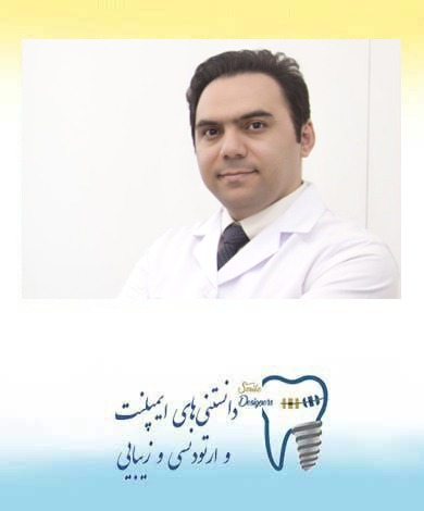 بهترین متخصص ایمپلنت دندان