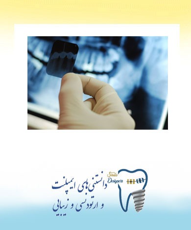 عکس پرتوی ایکس دندانپزشکی