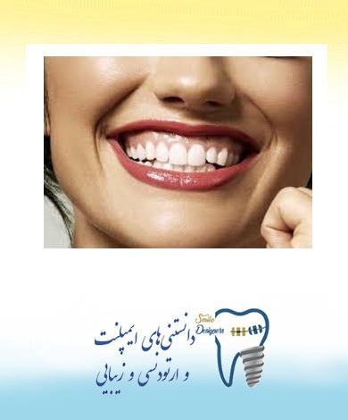 لبخند لثه ای  یا Gummy smile