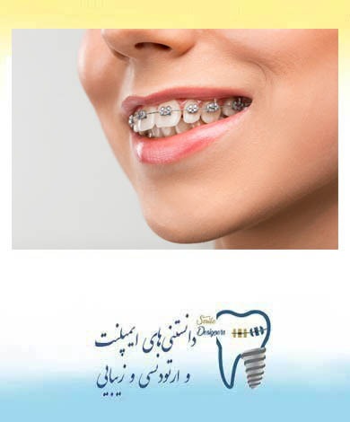 راه های کاهش مدت درمان ارتودنسی