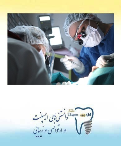پس از روکش کردن دندان چقدر طول میکشد دندان خوب شود؟