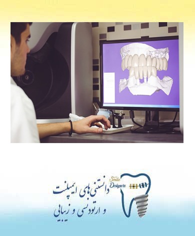پیوند استخوان پیش از کاشت ایمپلنت دندان