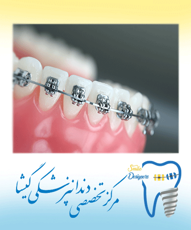 اولويت بندی درمان دندانپزشكي در بيماران ارتودنسي توسط متخصص ارتودنسی