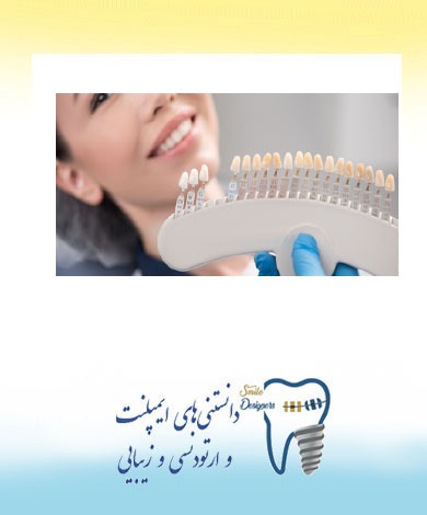 چه افرادی شرایط لمینت کردن دندان را دارند؟