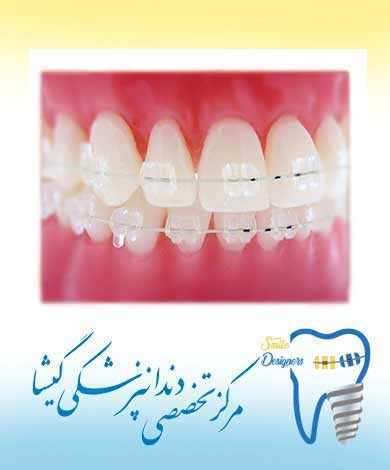 آيا مشكلات ارتودنسی قابل پيشگيری هستند؟