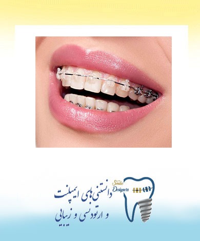 آيا ارتودنسی دردناك است؟