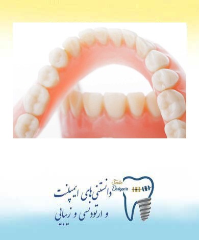 دندان مصنوعی چه مشکلاتی دارد؟