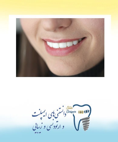لمینیت خیلی نازک یا لومینیرز چیست؟