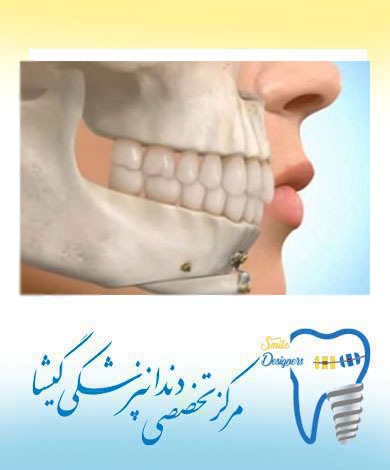 ارتودنسی يا ارتوسرجری؟